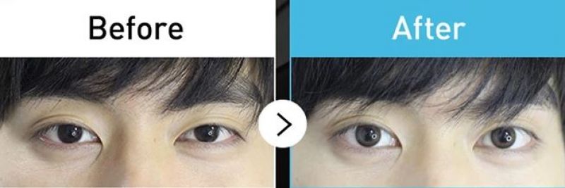 nam giới nhật bản đeo kính áp tròng